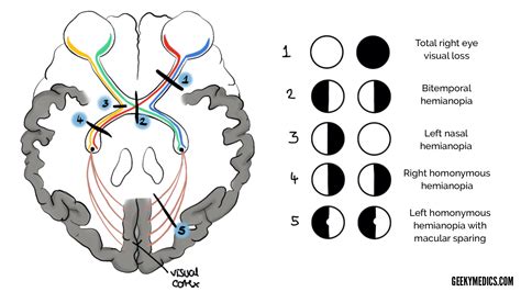 The Visual Field: what it is, how to get it tested, and more .